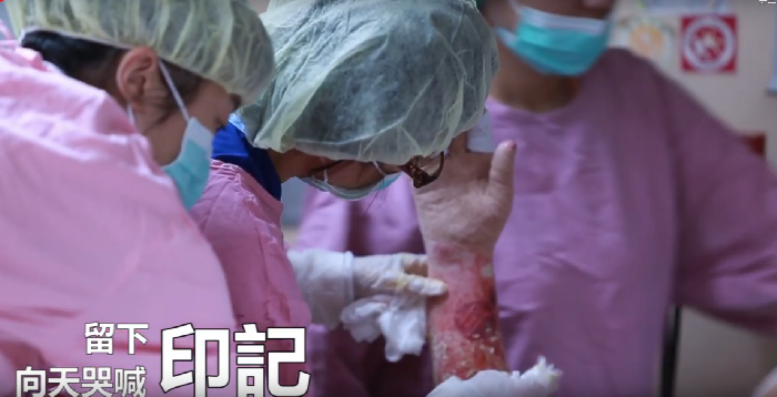 帶人也帶心，內科 ICU 病房護理長硬著頭皮說：「收了就要想辦法！」-八仙塵爆