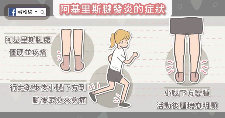 不是跑者也會得到的 – 阿基里斯腱肌腱炎-Achilles