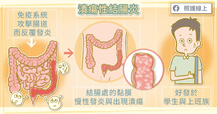 別信偏方！改善潰瘍性結腸炎，醫師圖文解說-王俊偉醫師