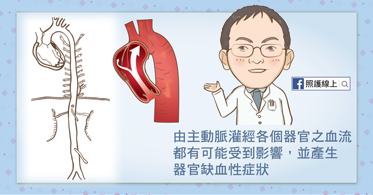 強烈撕裂性胸痛–主動脈剝離｜懶人包-上背痛