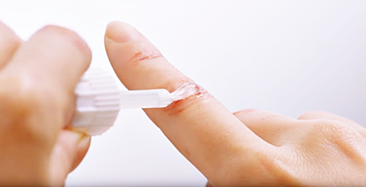 日本超夯「液體OK繃」傷口塗一層就防水，醫師說：這種傷口絕對不能用！-人工皮