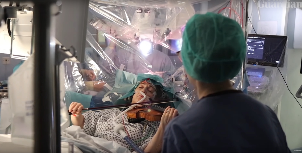 小提琴手長腦瘤 醫師要她一邊開腦一邊拉琴-一邊開腦一邊拉小提琴