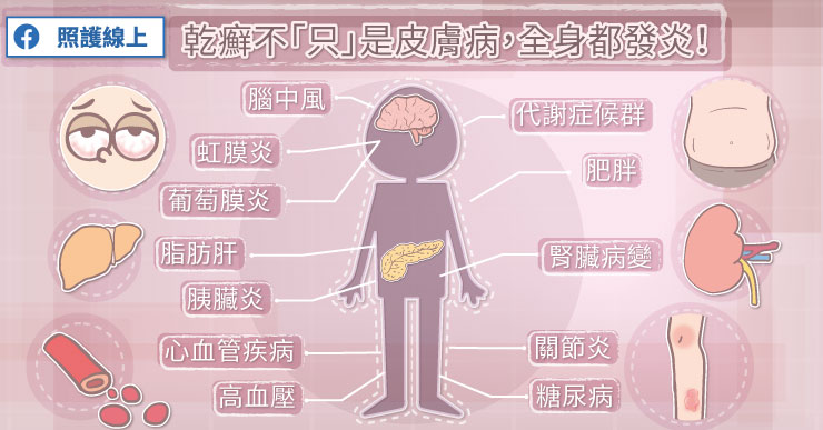 乾癬不「只」是皮膚病，全身都發炎！-克隆氏症