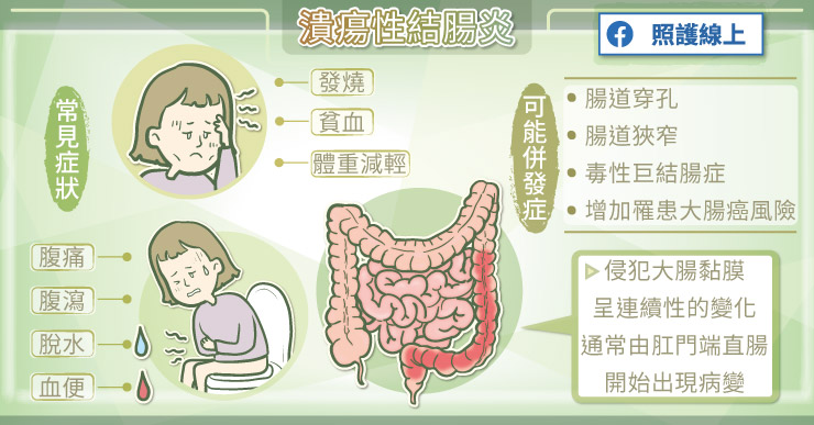 不是普通腹痛！讓腸道體無完膚的「潰瘍性結腸炎」-李炯宏醫師
