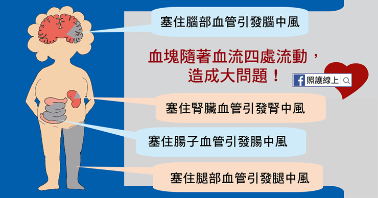 銀髮族「心房顫動」恐致死，醫師揭中風推手這5大族群要小心-中風