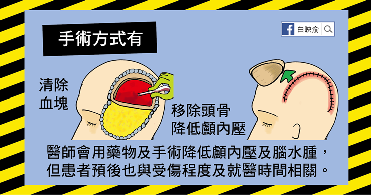 撞到頭沒症狀就沒事？出現這9種情況就可能有顱內出血！-白映俞醫師