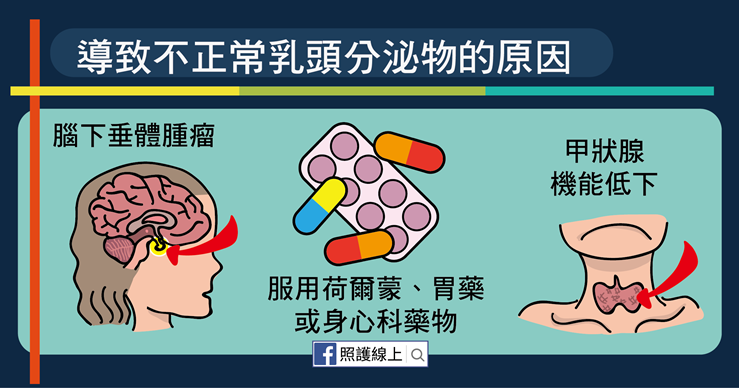 乳頭出現分泌物，到底正不正常？醫教從這三重點判斷-白映俞醫師