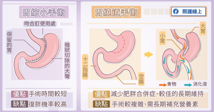 代謝手術vs減重手術哪個效果好？醫師圖文解析說分明-天晟醫院