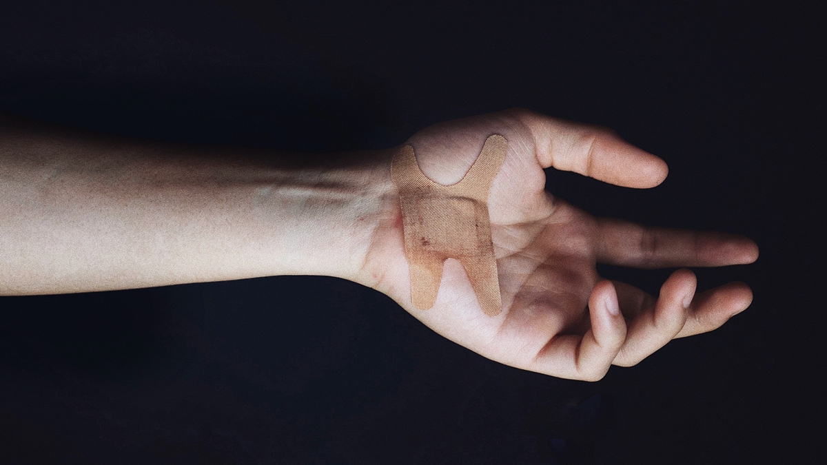 皮膚受傷貼人工皮就能痊癒？食藥署闢謠：用錯小心「細菌感染」-人工皮