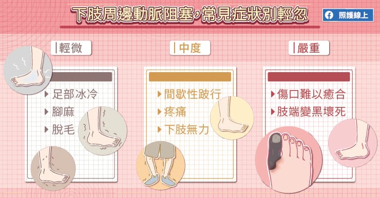 【名醫專訪】走10公尺都很困難！嚴重恐截肢的下肢周邊動脈阻塞-奇美醫院