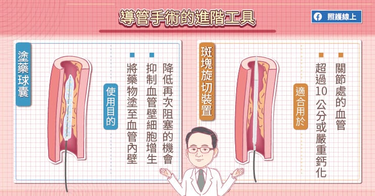【名醫專訪】走10公尺都很困難！嚴重恐截肢的下肢周邊動脈阻塞-奇美醫院