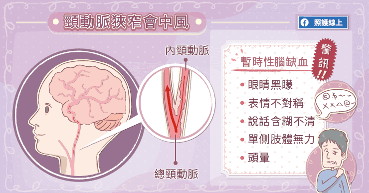 【名醫專訪】眼前突然一片黑！是嚴重健康警訊？醫：頸動脈狹窄5大前兆你一定要警覺-缺血性中風
