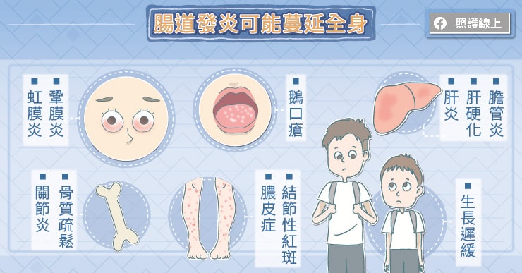 【名醫專訪】20～40歲小心！拉肚子超過4週別以為只是腸胃炎-小港醫院