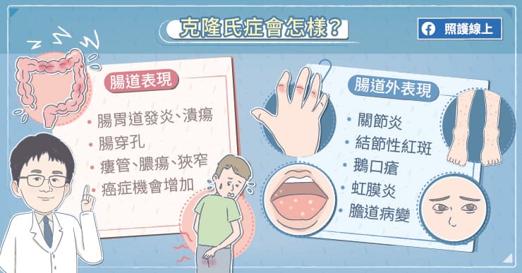 【名醫專訪】關節痛、紅眼睛，竟是腸子在作怪!? 醫師圖解克隆氏症-自體免疫失調