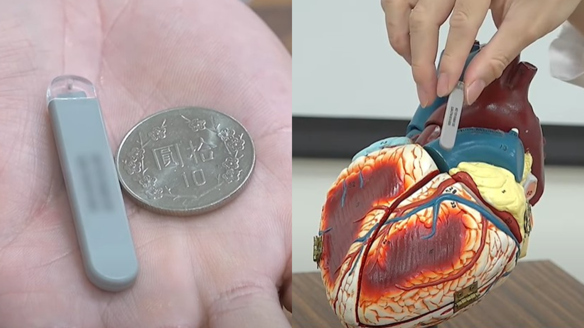 心臟不適找不出原因？ 最新心臟監測器 精準揪潛在疾病-Apple Watch