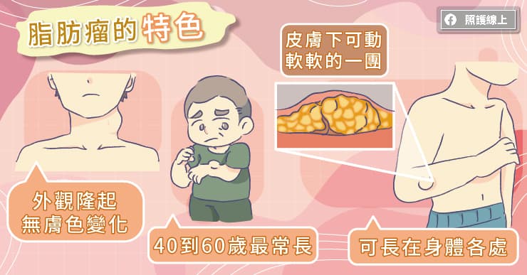 跟體脂肪無關，脂肪瘤怎麼辦？