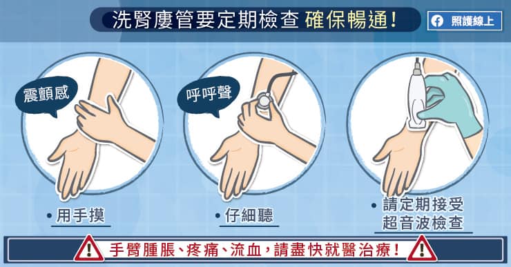 名醫專訪》洗腎病人的生命線談如何照顧「洗腰子的手筋」-大林慈濟醫院