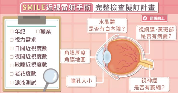 SMILE近視雷射手術，術前檢查、術後照顧STEP BY STEP，眼科醫師圖解-LASIK