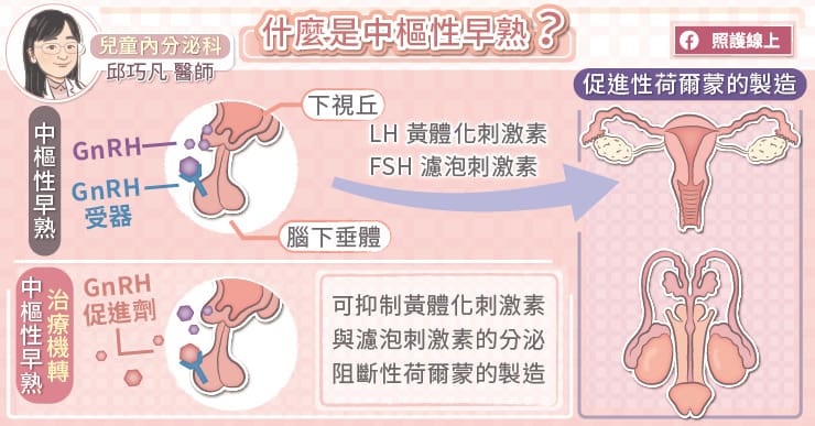 身高贏在起跑點恐怕是禍不是福?! 美女醫：中樞性早熟治療，不會影響未來的生育能力-GnRH促進劑