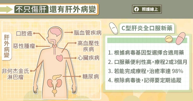 放任C肝不治療?! 醫警告：若染新冠肺炎死亡風險大增3.3倍！-COVID-19