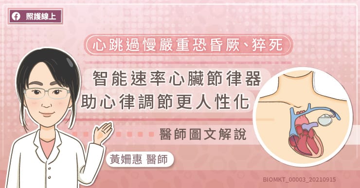 心跳過慢嚴重恐昏厥、猝死 智能速率心臟節律器助心律調節更人性化
