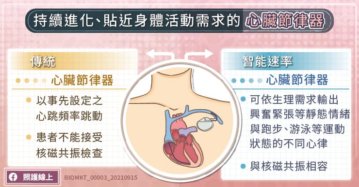 心跳過慢嚴重恐昏厥、猝死 智能速率心臟節律器助心律調節更人性化
