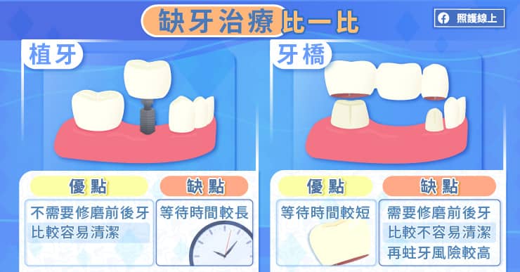 名醫專訪》缺牙怎麼辦？不處理會怎樣？植牙與牙橋 牙醫師圖文解析-牙周病