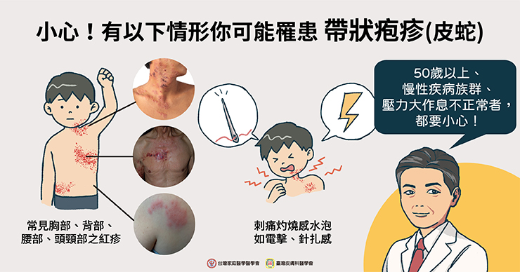 名醫專訪》「罩」不住的病毒怎麼防？面對帶狀疱疹醫師這麼說-COVID-19疫苗