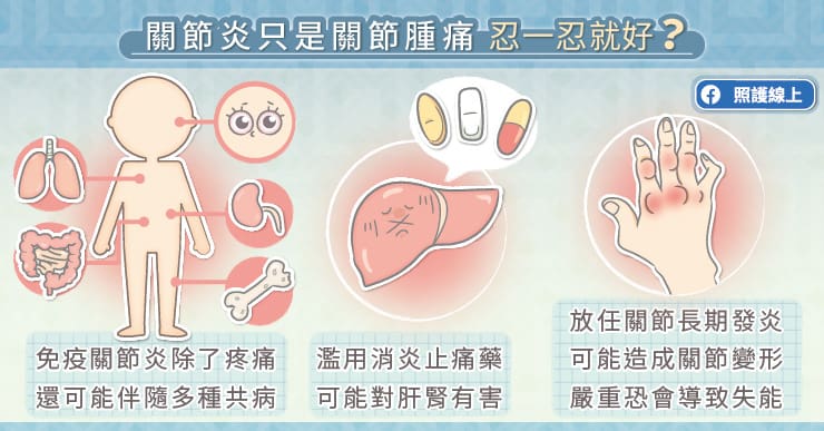 自體免疫性關節炎，迷思要破解！醫師圖文剖析
