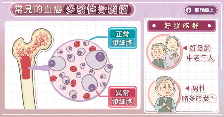 精準醫療突破治療瓶頸，控制多發性骨髓瘤，血癌專家圖文解說-白血病