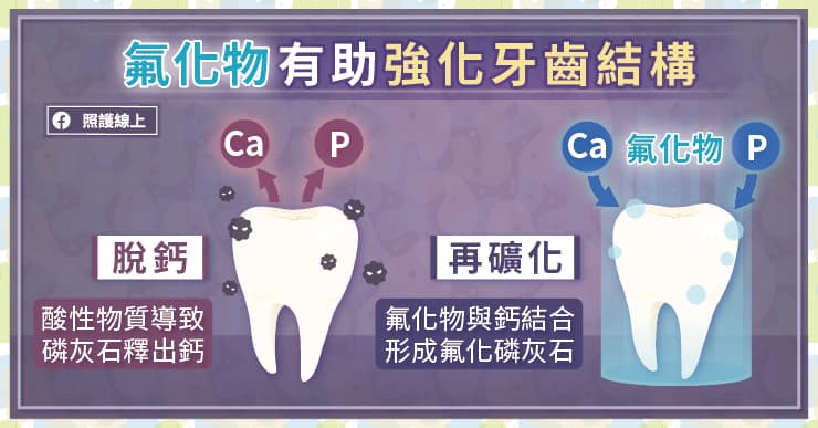 氟漆、氟膠有何差別？正確塗氟預防蛀牙、強化琺瑯質，牙醫師圖文解說-牙托