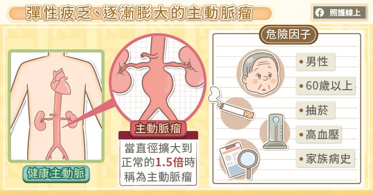 對付困難腹主動脈瘤，血管內固定錨釘很關鍵，心臟血管外科主任圖解說明