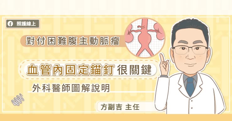對付困難腹主動脈瘤，血管內固定錨釘很關鍵，心臟血管外科主任圖解說明