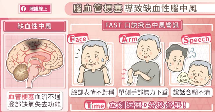 再次腦中風機率高！疫情期間別停藥醫師圖說日常保養、治療預防重點-中國醫藥大學附設醫院