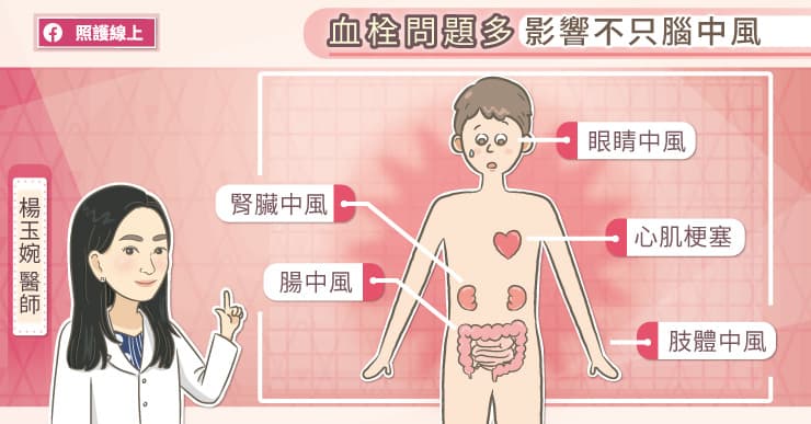 再次腦中風機率高！疫情期間別停藥醫師圖說日常保養、治療預防重點-中國醫藥大學附設醫院