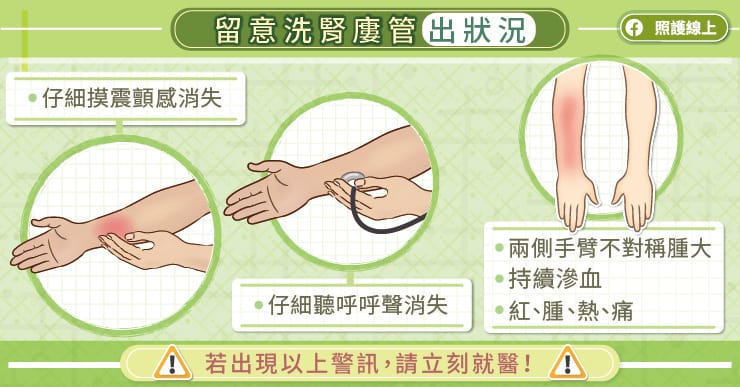 留意警訊，及時搶通洗腎廔管，血管外科醫師圖解懶人包