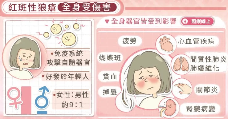 紅斑性狼瘡傷心、傷腎、又傷肺，慢性咳嗽當心肺纖維化-自體免疫疾病