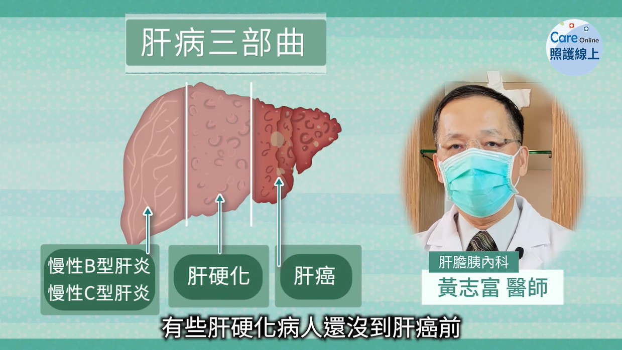 當心！出現這些症狀，及早治療莫拖延，醫師：70％肝癌都它引起-B肝帶原者