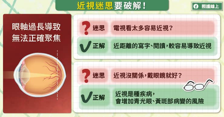 破解迷思！兒童近視要積極控制，專用日拋、角膜塑型片、散瞳藥水比一比，眼科醫師圖文解析-日拋隱形眼鏡