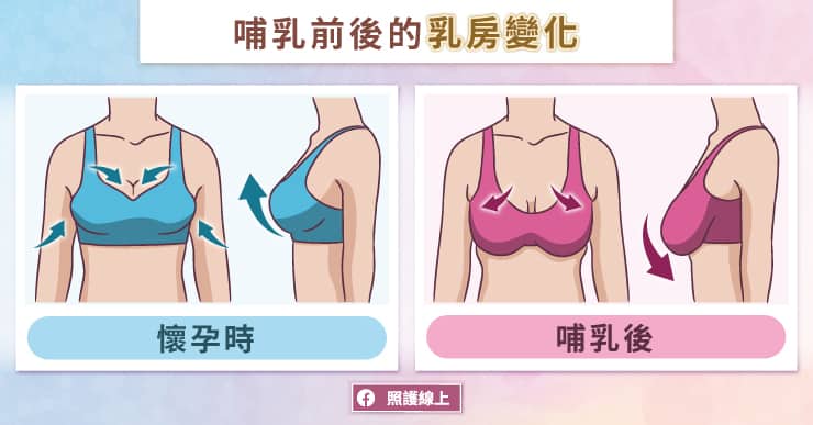 妳各位照過來！乳房變化到底正常？不正常｜醫師圖解-更年期