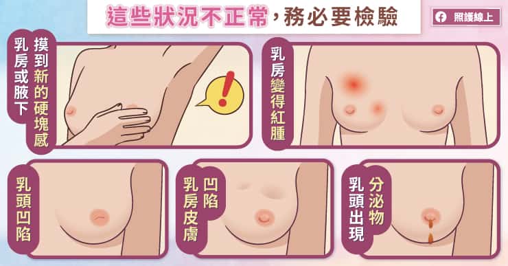 妳各位照過來！乳房變化到底正常？不正常｜醫師圖解-更年期
