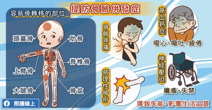 坐著看報竟骨折、癱瘓！對抗癌症骨轉移，肺癌專家圖文解析-高血鈣