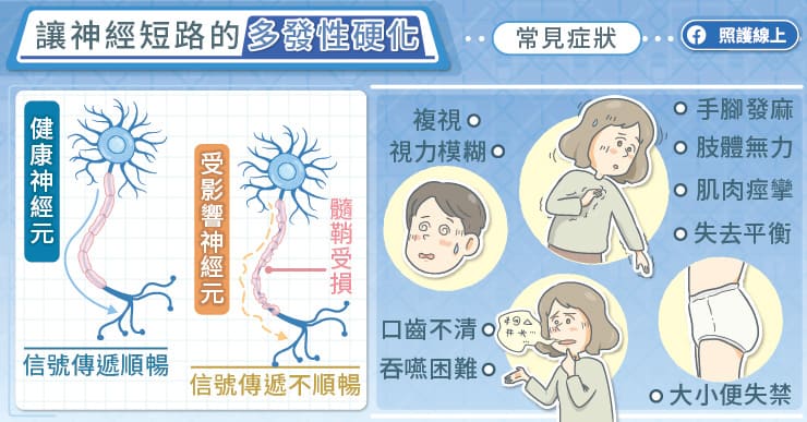 破壞神經，從頭到腳都有事的多發性硬化症，積極治療維持神經功能，醫師圖文詳解-中樞神經系統