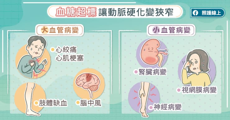 預防中風、心肌梗塞，記得調整控糖藥｜心臟專科醫師圖文解析-中風