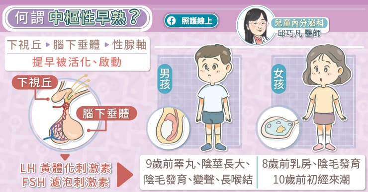 青春期還沒到，為何孩子會性早熟？｜醫師圖解懶人包-下視丘錯構瘤