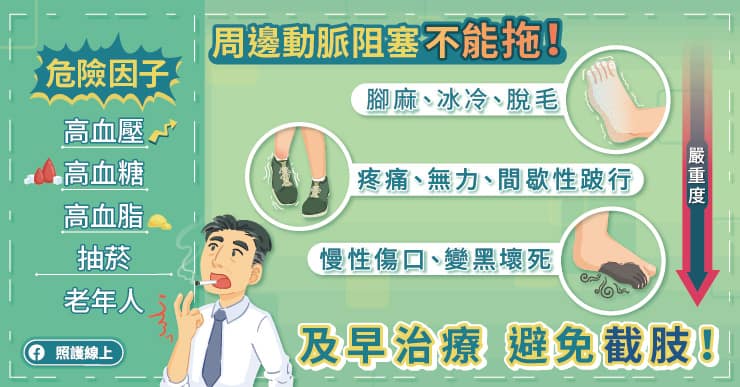 抽菸竟造成跛腳！不理會這五個危險因子，引起「周邊動脈阻塞」恐截肢-林口長庚醫院