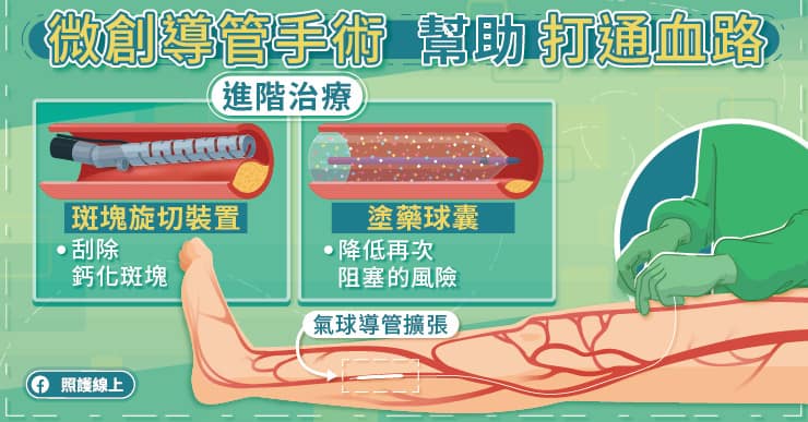 抽菸竟造成跛腳！不理會這五個危險因子，引起「周邊動脈阻塞」恐截肢-林口長庚醫院