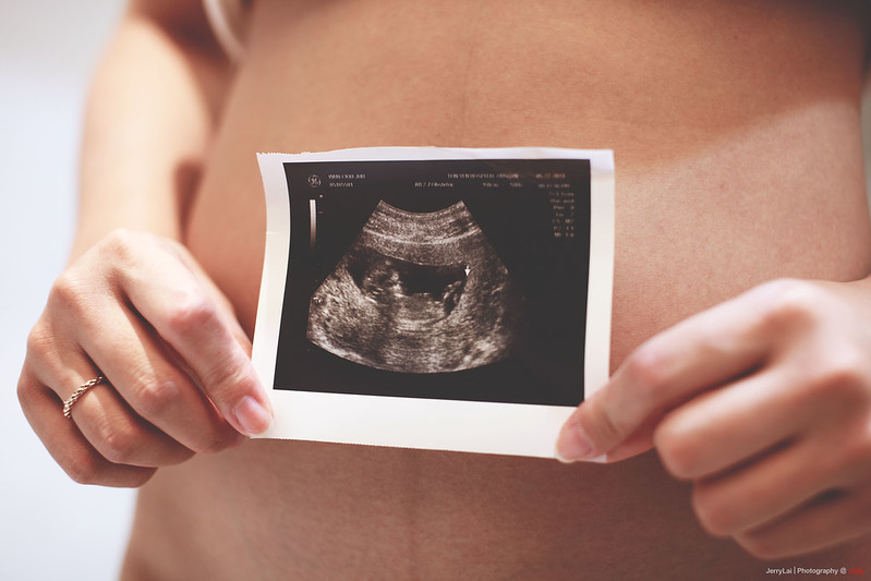 超過一年沒自然受孕就是不孕！原來與「這數量異常」有關，想懷孕醫師建議這樣做-PGS染色體篩檢