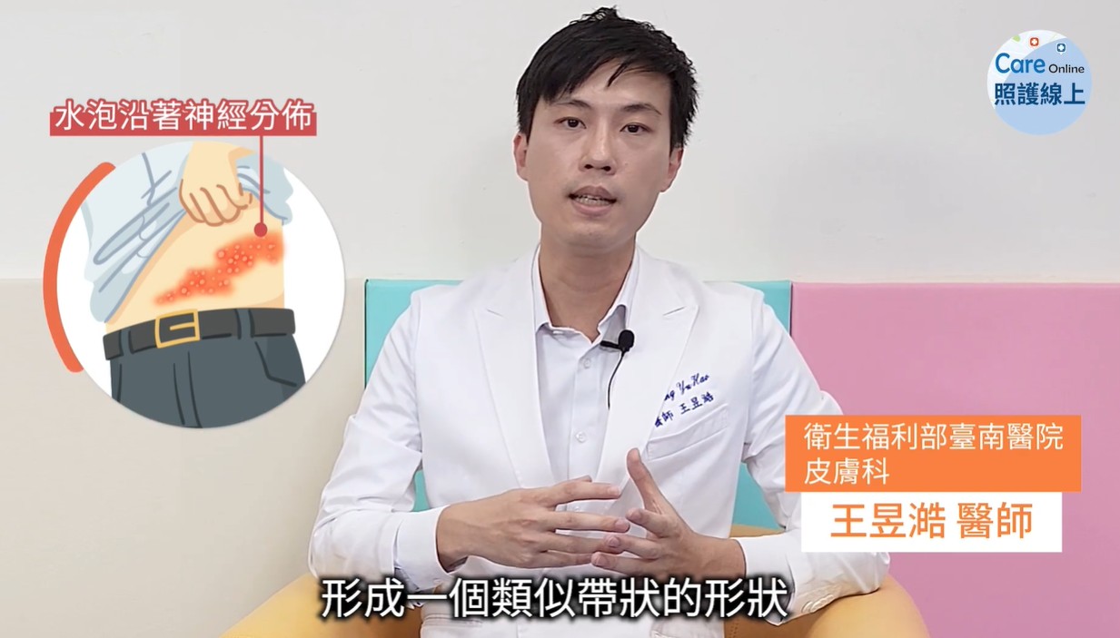 帶狀皰疹如何預防、治療？惱人神經痛怎麼改善？醫師建議可以這樣做-王昱澔醫師