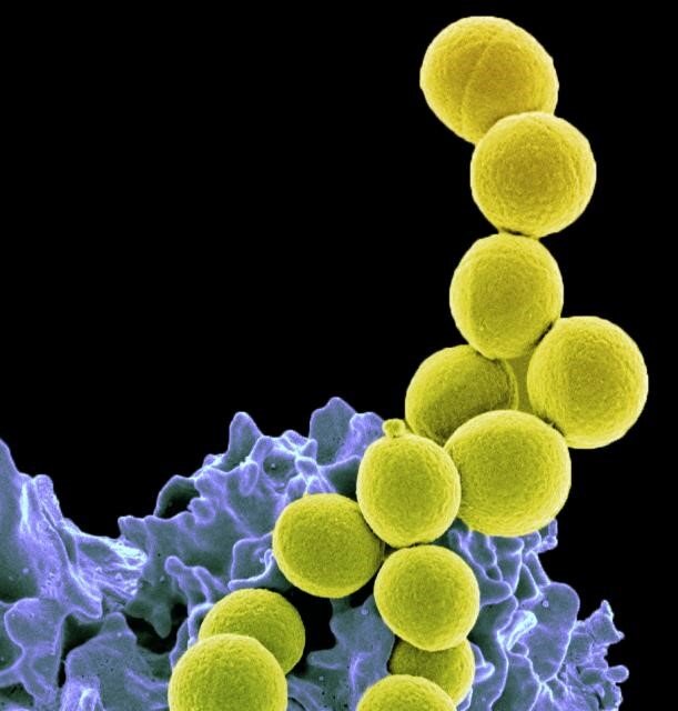 益生菌療法新發現 有效抑制超級細菌移生-MRSA